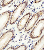 Immunohistochemical analysis of paraffin-embedded H. stomach section using CSE1L Antibody. Antibody was diluted at 1:100 dilution. A peroxidase-conjugated goat anti-rabbit IgG at 1:400 dilution was used as the secondary antibody, followed by DAB staining.