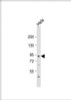 Western Blot at 1:1000 dilution + Hela whole cell lysate Lysates/proteins at 20 ug per lane.