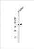 Western Blot at 1:500 dilution + human spleen lysate Lysates/proteins at 20 ug per lane.