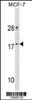 Western blot analysis in MCF-7 cell line lysates (35ug/lane) .