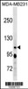 Western blot analysis in MDA-MB231 cell line lysates (35ug/lane) .