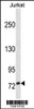 Western blot analysis in Jurkat cell line lysates (35ug/lane) .