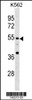 Western blot analysis in K562 cell line lysates (35ug/lane) .