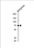 Western blot analysis of lysate from mouse thymus tissue lysate, using Mouse Ephb6 Antibody at 1:1000 at each lane.