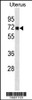 Western blot analysis in human Uterus tissue lysates (35ug/lane) .