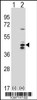 Western blot analysis of RCL1 using rabbit polyclonal RCL1 Antibody using 293 cell lysates (2 ug/lane) either nontransfected (Lane 1) or transiently transfected (Lane 2) with the RCL1 gene.