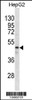 Western blot analysis in HepG2 cell line lysates (35ug/lane) .