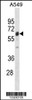 Western blot analysis in A549 cell line lysates (35ug/lane) .