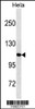 Western blot analysis in Hela cell line lysates (35ug/lane) .