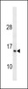 Western blot analysis in ZR-75-1 cell line lysates (35ug/lane) .