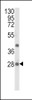 Western blot analysis of EIF4E2 Antibody in NCI-H460 cell line lysates (35ug/lane)