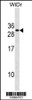 Western blot analysis in WiDr cell line lysates (35ug/lane) .