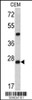 Western blot analysis of Dcr-1 antibody in CEM cell line lysates (35ug/lane)