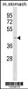 Western blot analysis in mouse stomach tissue lysates (35ug/lane) .