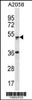 Western blot analysis in A2058 cell line lysates (35ug/lane) .