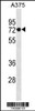 Western blot analysis in A375 cell line lysates (35ug/lane) .