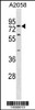 Western blot analysis in A2058 cell line lysates (35ug/lane) .