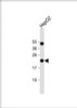 Western Blot at 1:1000 dilution + HepG2 whole cell lysate Lysates/proteins at 20 ug per lane.