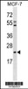 Western blot analysis in MCF-7 cell line lysates (35ug/lane) .