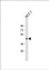 Western Blot at 1:2000 dilution + MCF-7 whole cell lysate Lysates/proteins at 20 ug per lane.