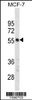 Western blot analysis in MCF-7 cell line lysates (35ug/lane) .