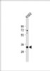 Western Blot at 1:1000 dilution + K562 whole cell lysate Lysates/proteins at 20 ug per lane.