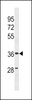 Western blot analysis in human Uterus tissue lysates (35ug/lane) .