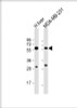 Western Blot at 1:8000 dilution Lane 1: human liver lysate Lane 2: MDA-MB-231 whole cell lysate Lysates/proteins at 20 ug per lane.