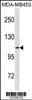 Western blot analysis in MDA-MB453 cell line lysates (35ug/lane) .