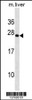 Western blot analysis in mouse liver tissue lysates (35ug/lane) .