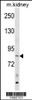 Western blot analysis in mouse kidney tissue lysates (35ug/lane) .