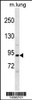 Western blot analysis in mouse lung tissue lysates (35ug/lane) .This demonstrates the detected the Mouse Pik3r1 protein (arrow) .