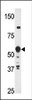 Western blot analysis of anti-HDBP2 (HDRF-2) Antibody in Y79 cell line lysates (35ug/lane) .