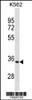 Western blot analysis in K562 cell line lysates (35ug/lane) .