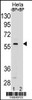 SMAD5 Antibody pre-incubated without (lane 1) and with (lane 2) blocking peptide in Hela cell line lysate. SMAD5 Antibody (arrow) was detected using the purified Pab.