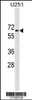 Western blot analysis in U251 cell line lysates (35ug/lane) .