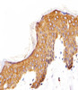 Immunohistochemical analysis of paraffin-embedded H. skin section using EGFR Antibody (N-term) . Antibody was diluted at 1:25 dilution. A undiluted biotinylated goat polyvalent antibody was used as the secondary, followed by DAB staining.