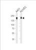 Western blot analysis of lysates from A431, HUVEC cell line (from left to right) , using EGFR Antibody at 1:1000 at each lane.