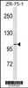 Western blot analysis in ZR-75-1 cell line lysates (35ug/lane) .