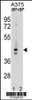 OR5AC2 Antibody pre-incubated without (lane 1) and with (lane 2) blocking peptide in A375 cell line lysate. OR5AC2 Antibody (arrow) was detected using the purified Pab.