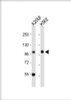 Western Blot at 1:1000 dilution Lane 1: A2058 whole cell lysate Lane 2: K562 whole cell lysate Lysates/proteins at 20 ug per lane.