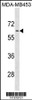 Western blot analysis in MDA-MB453 cell line lysates (35ug/lane) .