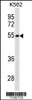 Western blot analysis in K562 cell line lysates (35ug/lane) .