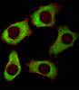 Fluorescent image of A549 cell stained with YBX1 Antibody . A549 cells were fixed with 4% PFA (20 min) , permeabilized with Triton X-100 (0.1%, 10 min) , then incubated with YBX1 primary antibody (1:25) . For secondary antibody, Alexa Fluor 488 conjugated donkey anti-rabbit antibody (green) was used (1:400) .Cytoplasmic actin was counterstained with Alexa Fluor 555 (red) conjugated Phalloidin (7units/ml) . YBX1 immunoreactivity is localized to Cytoplasm significantly.