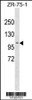 Western blot analysis in ZR-75-1 cell line lysates (35ug/lane) .