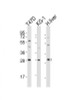 Western Blot at 1:2000 dilution Lane 1: T47D whole cell lysates Lane 2: KG-1 whole cell lysates Lane 3: human liver lysates Lysates/proteins at 20 ug per lane.