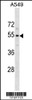 Western blot analysis in A549 cell line lysates (35ug/lane) .