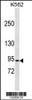 Western blot analysis in K562 cell line lysates (35ug/lane) .