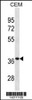 Western blot analysis in CEM cell line lysates (35ug/lane) .