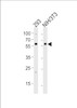 Western blot analysis of lysates from 293, mouse NIH/3T3 cell line (from left to right) , using BMPR1A Antibody (C180) at 1:1000 at each lane.